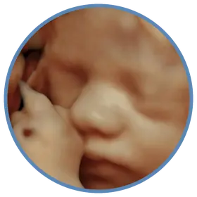 Imagem em 3D do rosto fetal na avaliação de crescimento com Doppler — Viváx Medicina Diagnóstica
