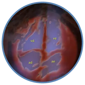 Corte de quatro câmaras do coração fetal com Doppler colorido — ecocardiografia fetal na Viváx Medicina Diagnóstica