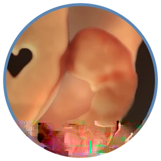 Imagem em 3D de embrião obtida em ultrassonografia obstétrica na Viváx Medicina Diagnóstica