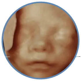 Imagem em 3D do rosto fetal no morfológico de 2º trimestre — Viváx Medicina Diagnóstica