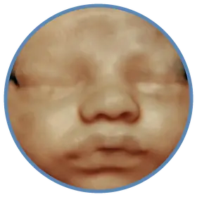 Imagem em 3D do rosto fetal no morfológico de 3º trimestre — Viváx Medicina Diagnóstica