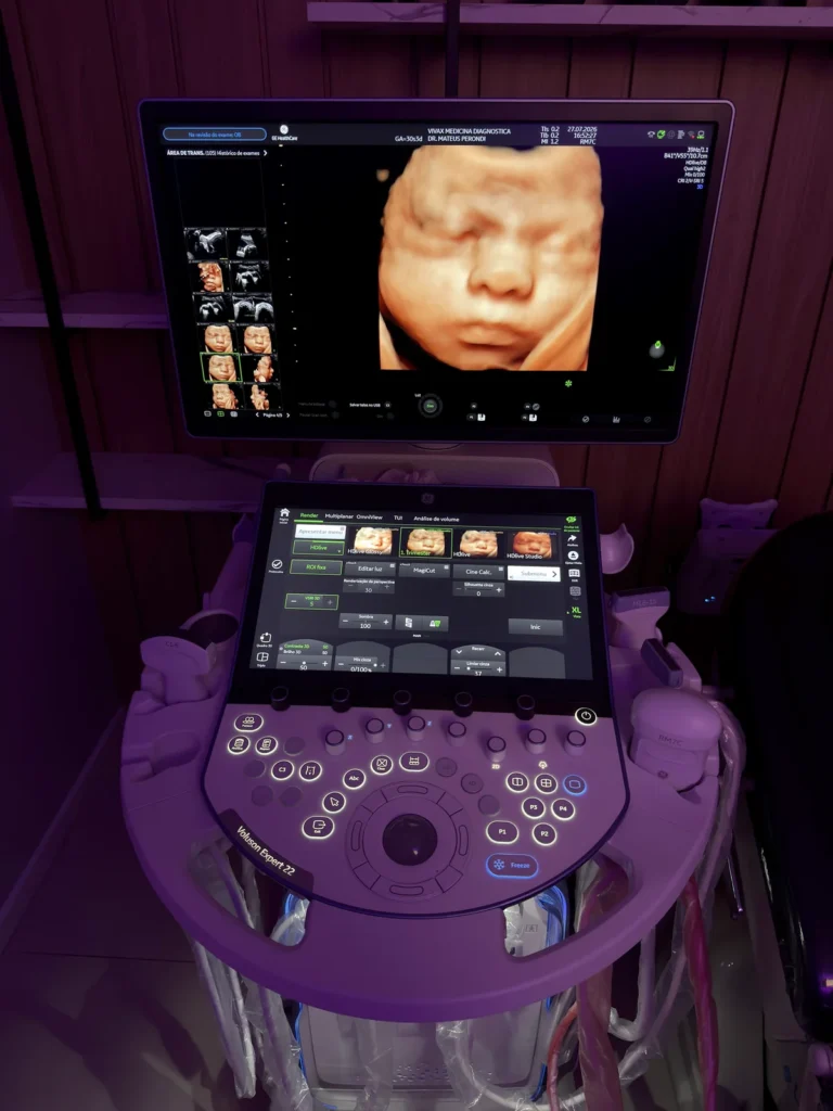 Aparelho de ultrassom GE Voluson Expert 22 na Viváx Medicina Diagnóstica, Francisco Beltrão