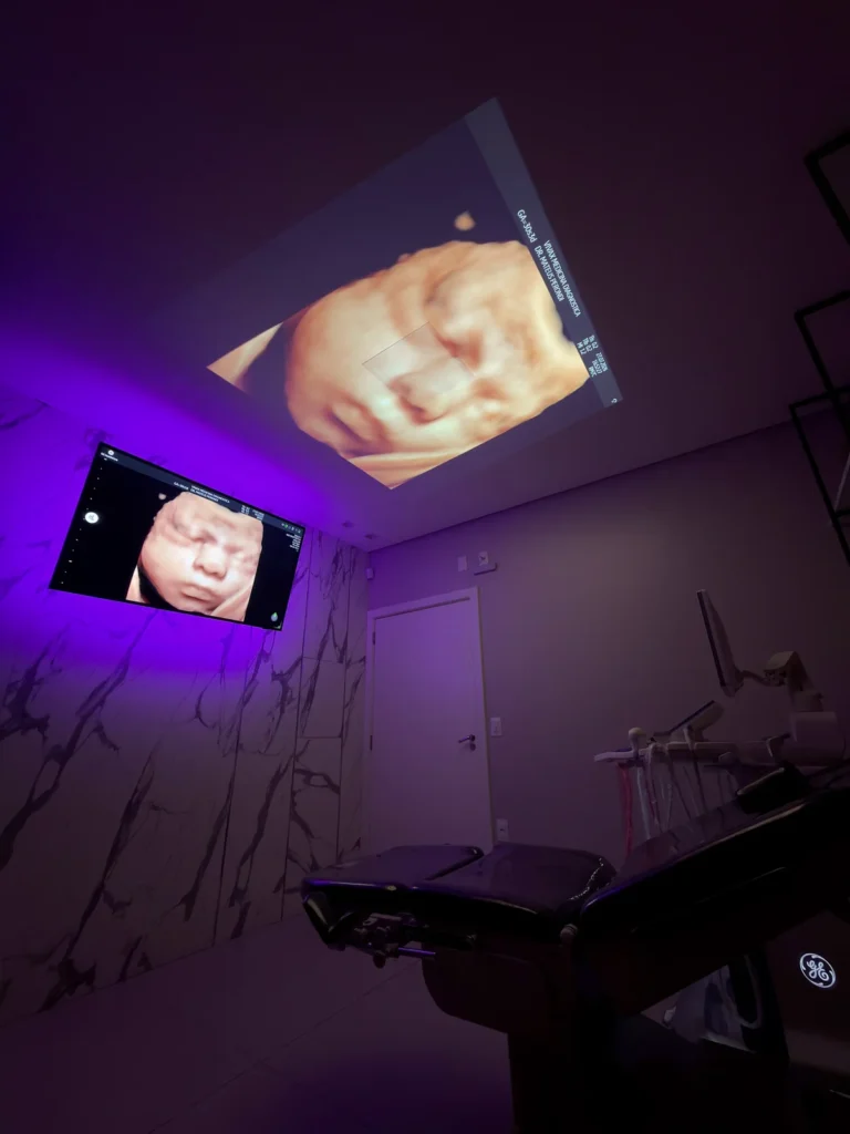 Sala de exames da Viváx Medicina Diagnóstica com projeção do ultrassom no teto, Francisco Beltrão
